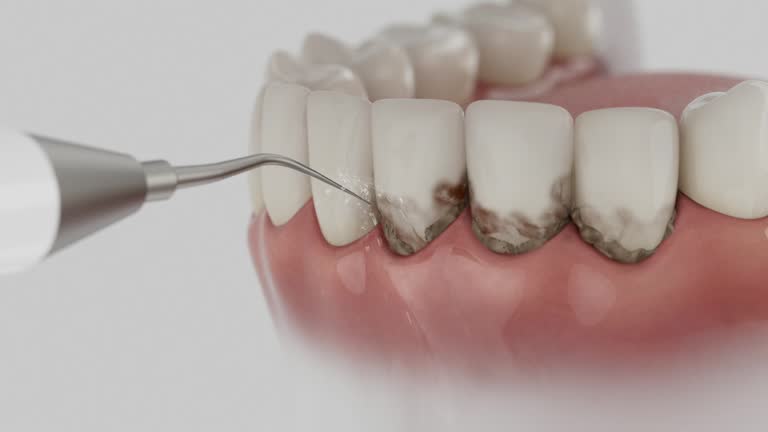 Reliable Dental Implants contractor in Ladson, SC by Smile Center Dentistry